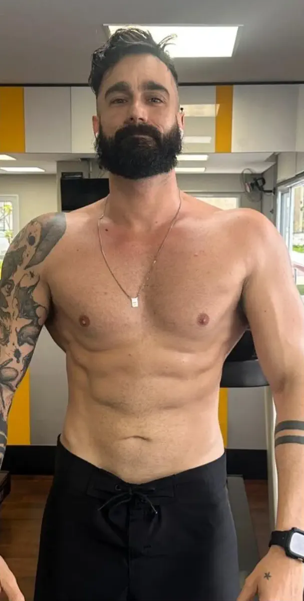 Felipe Hunziker depois